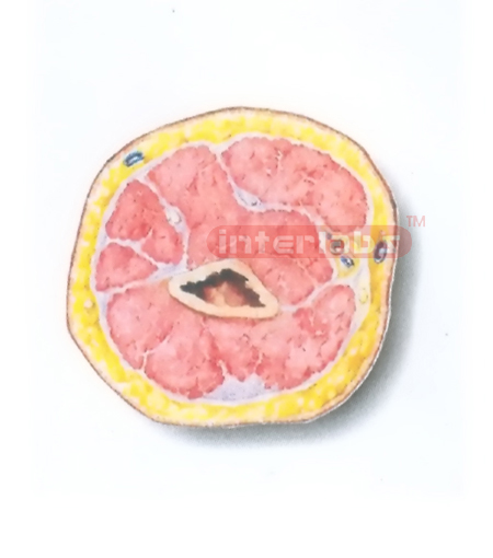 HUMAN TRANSVERSE SECTION MODEL THROUGH THE DISTAL 1/3 OF THE RIGHT ARM (C)